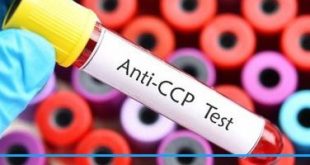 آزمایش Anti CCP